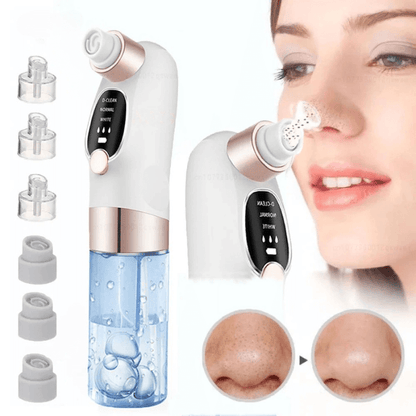 Rechargeable Pore Vacuum & Blackhead Remover