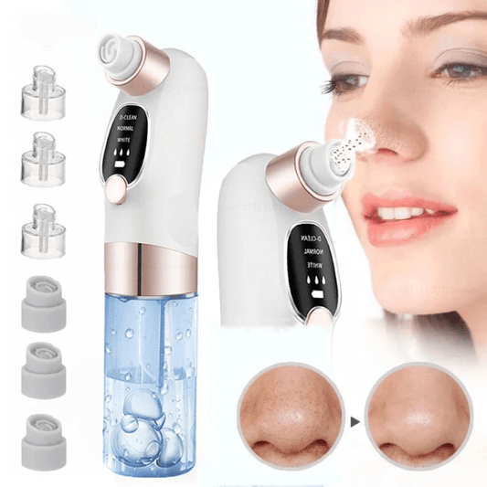 Rechargeable Pore Vacuum & Blackhead Remover