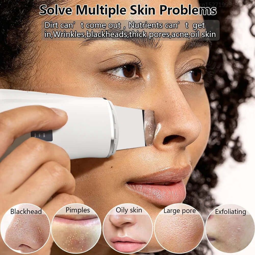 Ultrasonic Skin Scrubber & Blackhead Remover