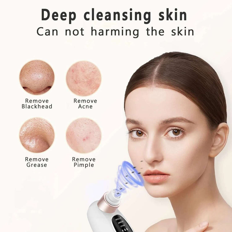 Rechargeable Pore Vacuum & Blackhead Remover
