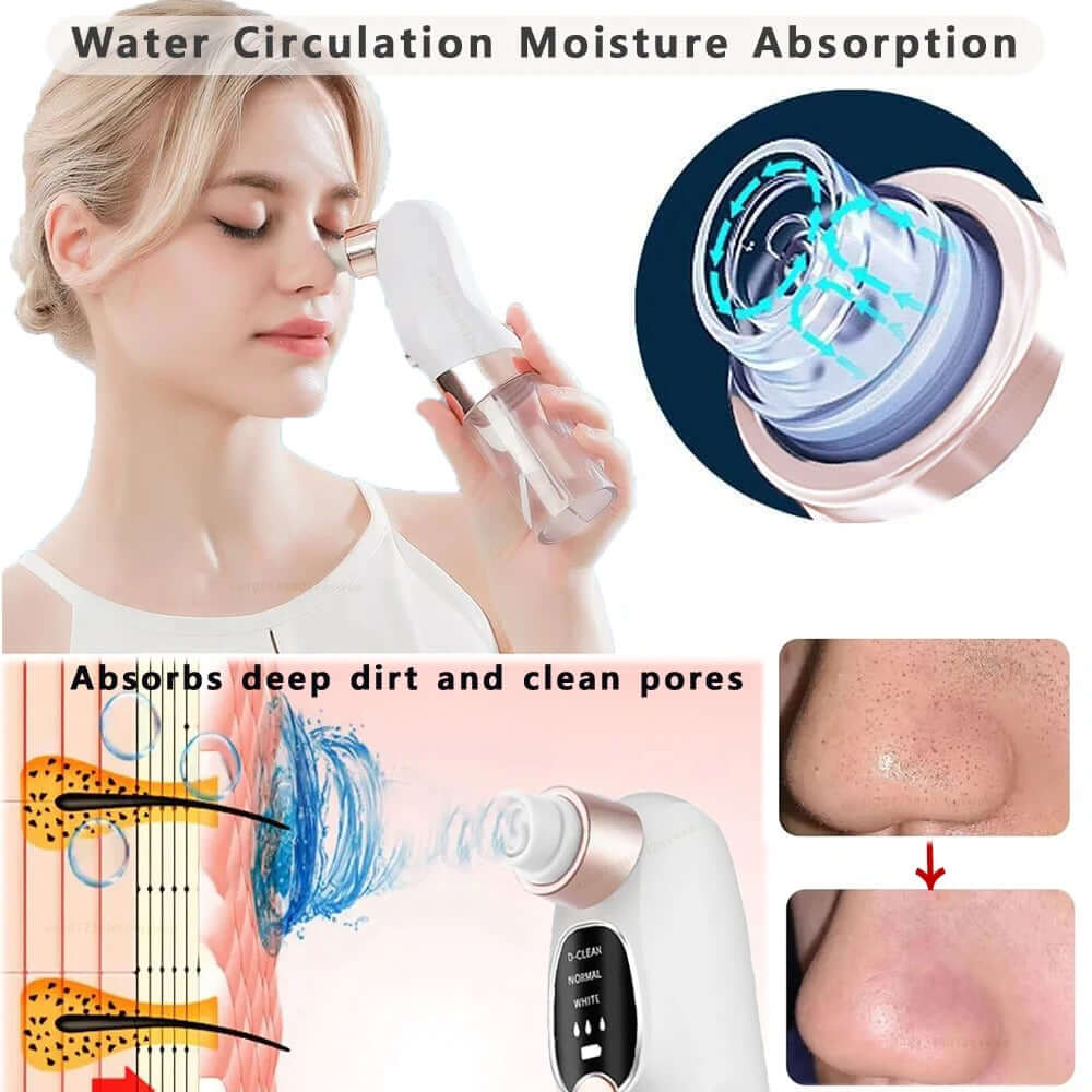 Rechargeable Pore Vacuum & Blackhead Remover