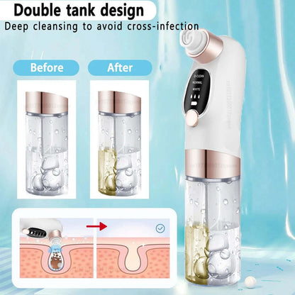 Rechargeable Pore Vacuum & Blackhead Remover