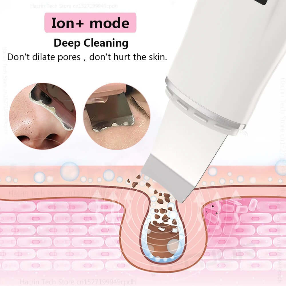 Ultrasonic Skin Scrubber & Blackhead Remover