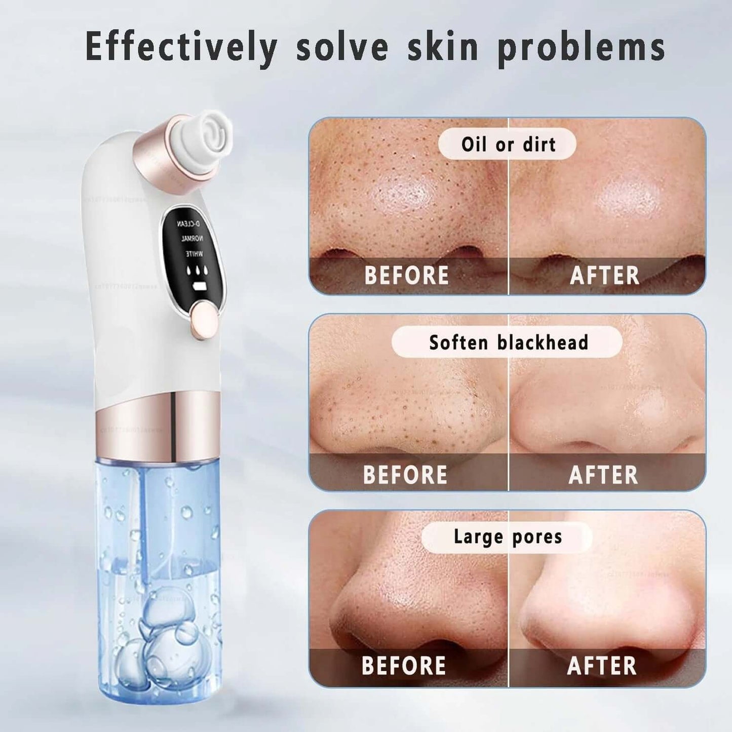 Rechargeable Pore Vacuum & Blackhead Remover